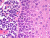Benz Microscope H&E Stain Kit, Hematoxylin (Ehrlichs) EosinLaboratory SuppliesLaboratory_Stains and ChemicalsBZ0921