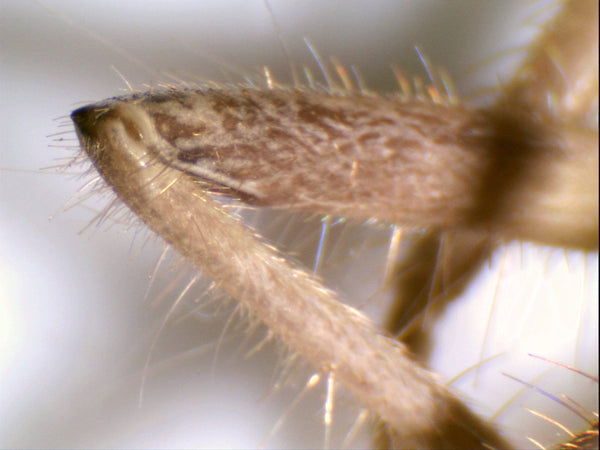 Viewing insect leg with Celestron 5 MP Digital Imager Camera (#44422)